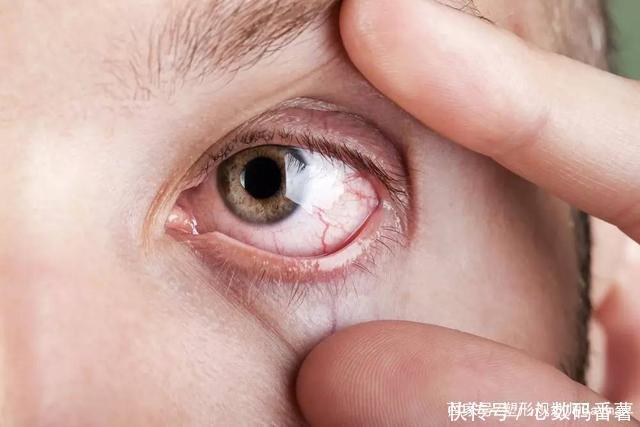41岁大姐烟酒不沾，失眠多梦气血差，医生忠告：1事不可天天做！