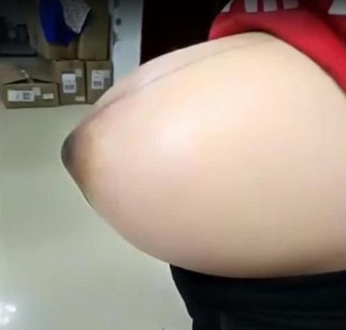 為啥懷孕后孕媽肚型都不同?醫生:跟胎兒性別沒關係,主要看3點