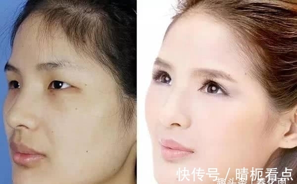 美白|实拍:10张女孩整容前后的对比照,这真就是换了一张脸