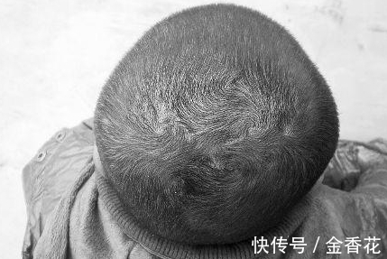 波壳君|孩子头上“发旋”越多,智商就越高吗?专家研究后大开眼界!