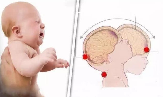 孩子|8个月男婴,被奶奶“哄成”脑瘫儿,竟还有家长不知悔改