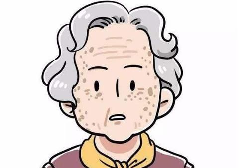 老年斑|不想老年斑到来,平时养成这6个习惯,老了不让人嫌弃!