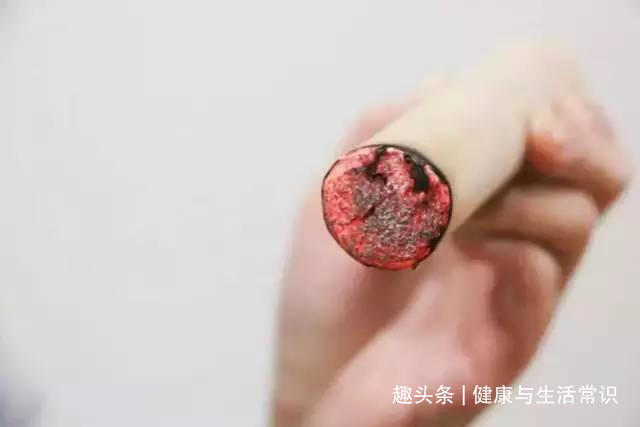 秘诀|三伏天3忌，3宜，3秘诀帮你去除湿气，健脾胃，补阳气