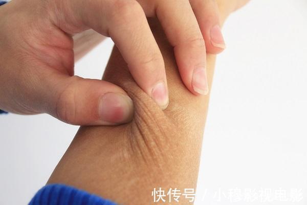 肝功|67岁男子，从肝硬化转为肝功正常，常吃一物，肝脏慢慢柔软