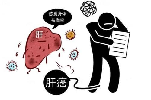 医院|体内有癌，肩膀第一个知道？肩膀出现这种迹象，最好去医院查肝CT