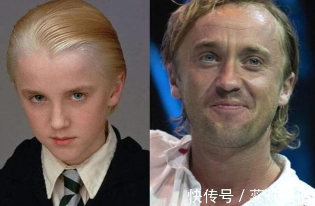 体重|5种孩子会越长越丑,长大也难避开“变丑”结局,希望没有你家娃