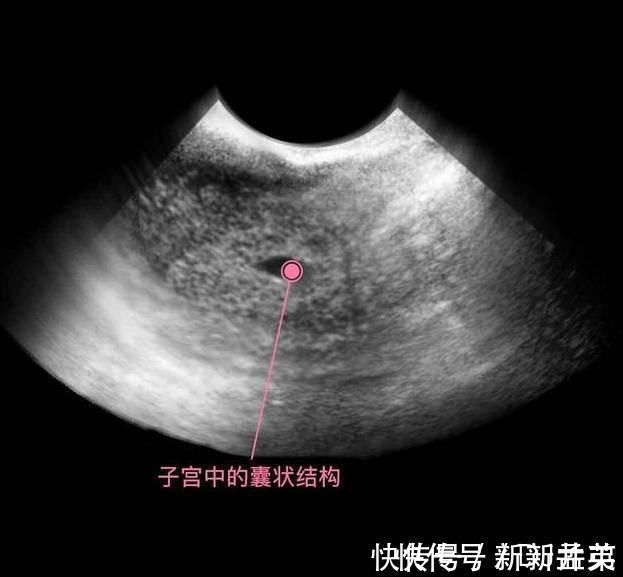 羊水|胎儿从卵泡到性别形成,17张图片清晰诠释,男宝女宝看得很清楚