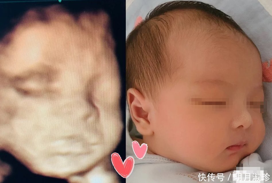 宝妈|有种“暖心”叫胎儿心疼孕妈，用这三种方式默默保护妈妈，感动！