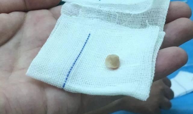 溺水|一个炒菜的功夫孩子就没了医生泣血忠告这些底线千万不要让孩子碰