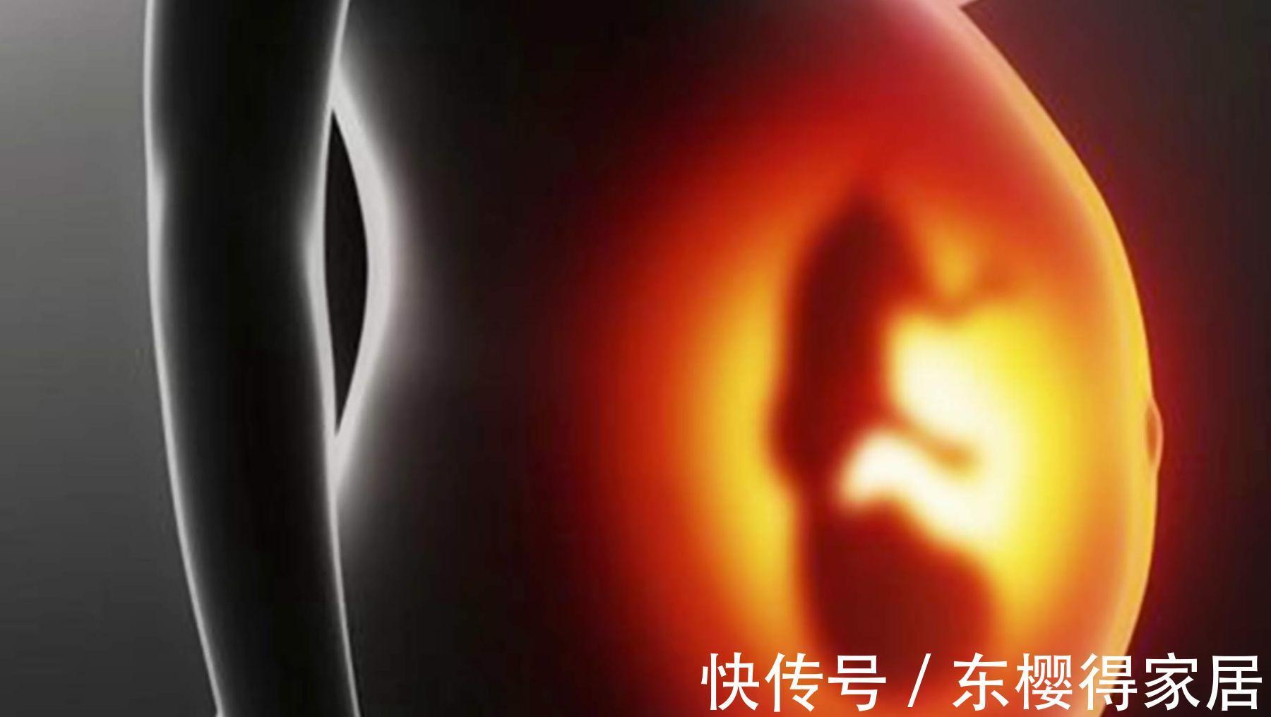 性格|胎儿的脾性更像谁?遗传学家:娘胎里就能判断一二,后期很难改