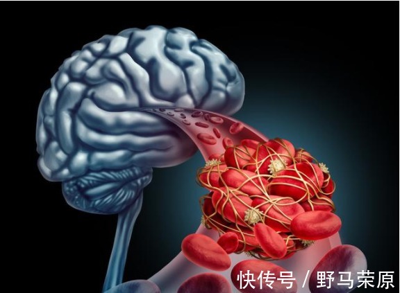 信号灯|老年痴呆早期的四大信号灯,你亮了几个做到这几点远离老年痴呆