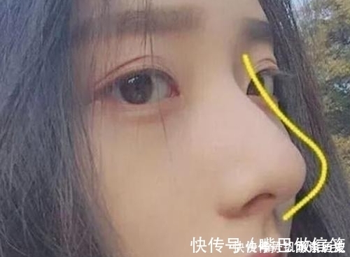 毛孔 鼻子上挤出“白色条状物”?护肤达人:学会这3招,“草莓鼻”再也与你无缘