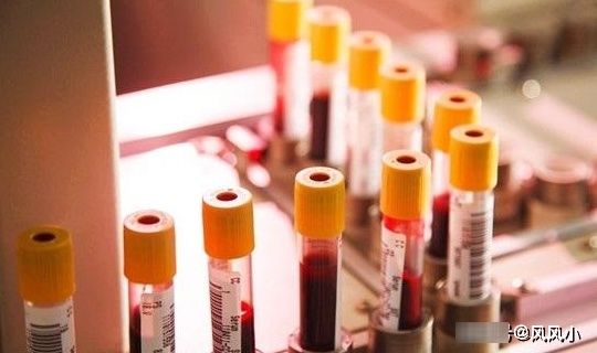 产检时，医院让做的这项检查，或许费钱还受罪，孕妈不要被安排