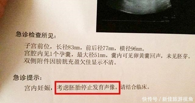 孕早期|为什么现在胎停发生率这么高拒绝胎死腹中，孕早期孕妈做好3点