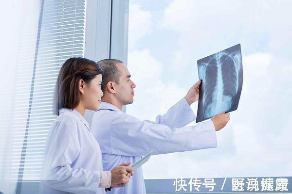 肺部|肺癌越来越普遍?患上肺癌的人,一般有4个“共性”,希望你没有