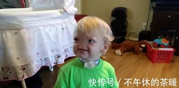 一生|小男孩天生无鼻,却坚持走完了一生