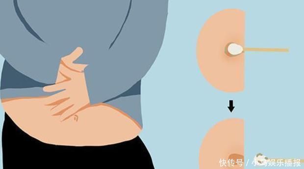 宝宝|为什么孕妇肚脐“有凸有凹”?与胎儿性别无关,大多是这5个原因