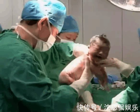 纹身|女子剖腹产,医生看到肚子上纹身笑着叫护士拍照