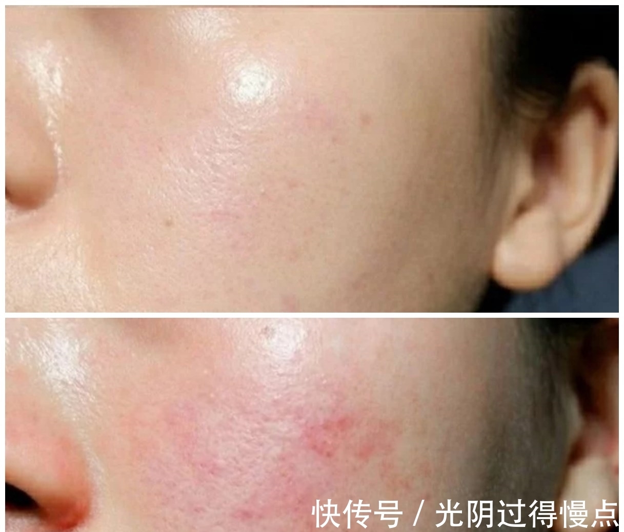 金盏花水 这几款国货护肤品风大但很鸡肋,刺激皮肤还烂脸,入手需谨慎