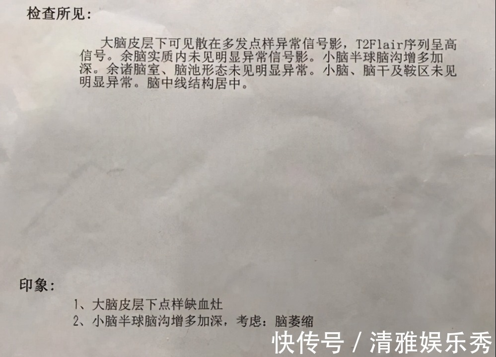 女孩|8岁女孩查出“脑萎缩”,医生叹息:2个坏习惯,别做不合格父母