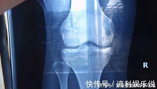 抓住|家长矮孩子就一定矮吗?抓住三个“猛涨期”,想有个大高个不是梦