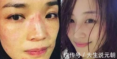 敏感肌|长期素颜和每天化妆的女人,坚持10年后,皮肤差异巨大