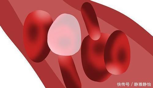 对血管好的零食,也是87岁国医的法宝,经常吃,血管重回年轻态