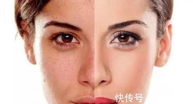 小米红枣粥|皮肤暗沉有斑点,试一试内调!这两样东西多吃点,不化妆也气色好