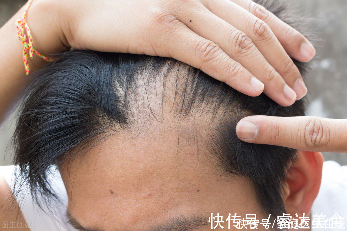 男性|男性近半年身体有6个表现，说明正在加速衰老？望你一个也没有