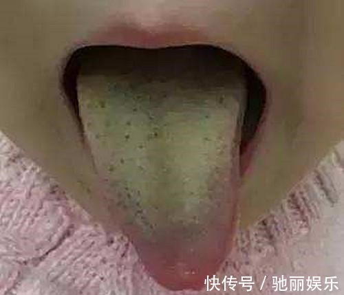 爷爷|4岁女孩肚子1米粗,像怀孕五个月,爷爷却说没事,吃的多胖点好