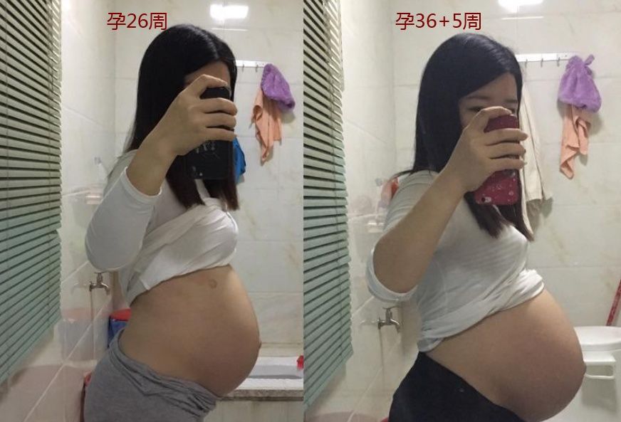 孕妇的“肚量”有多大一张图告诉你答案孕妇的内脏都被挤没了