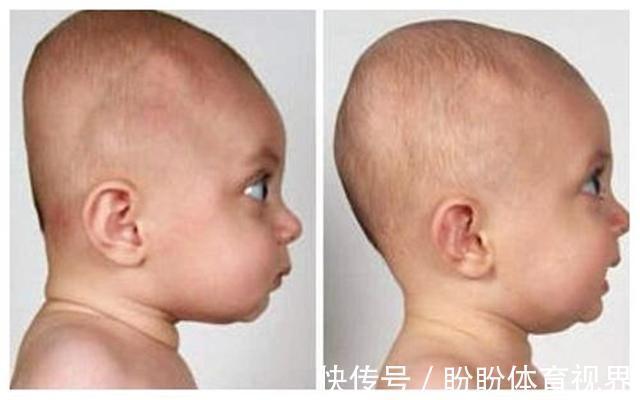 小洁|为什么以前的老人,执意要给孩子睡''扁头''?圆头更聪明?