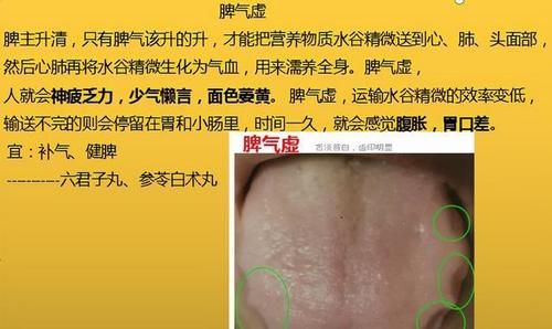 神疲乏力|脾气虚、脾阳虚，这6种脾虚，从初级到严重，你是属于哪一种？