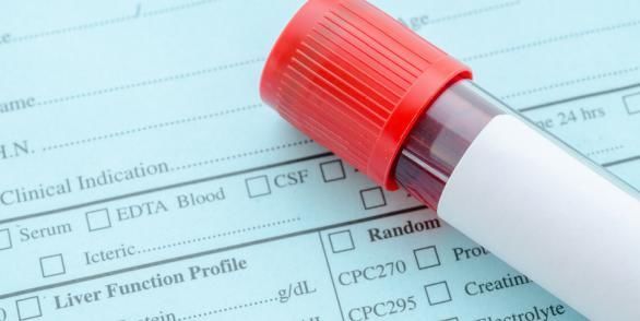 血液|来自大自然的“血稠药”，经常喝点，远离血栓、脑梗，人长寿！