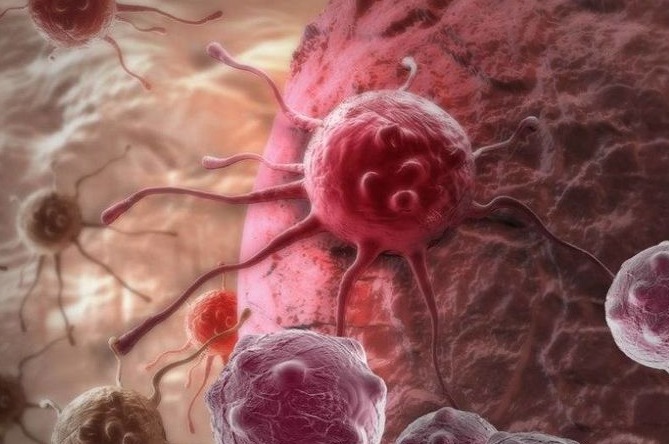 癌症患者|癌症究竟有多痛苦患癌的人,承受了生命不能承受的3种“痛”