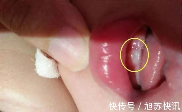 口腔|宝宝出牙的时间、症状表现以及注意事项,一篇讲清,宝妈要了解