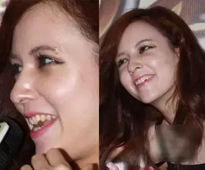 日本|为什么很多日本女孩的牙不整齐