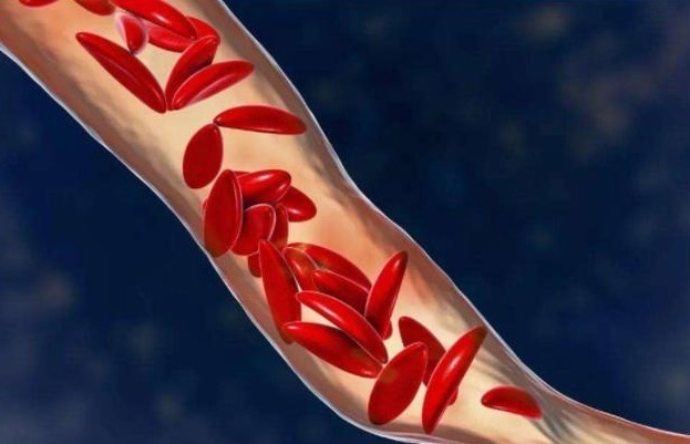 大医典|医生提醒:血脂过高的人,3种素食尽量少吃,升脂不比肥肉慢!