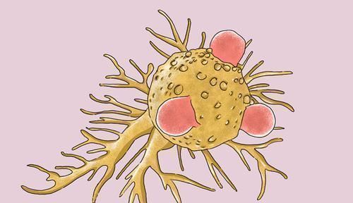 肺癌|女子肺癌7年,两次发生转移,都死里逃生,她的抗癌方法值得学习