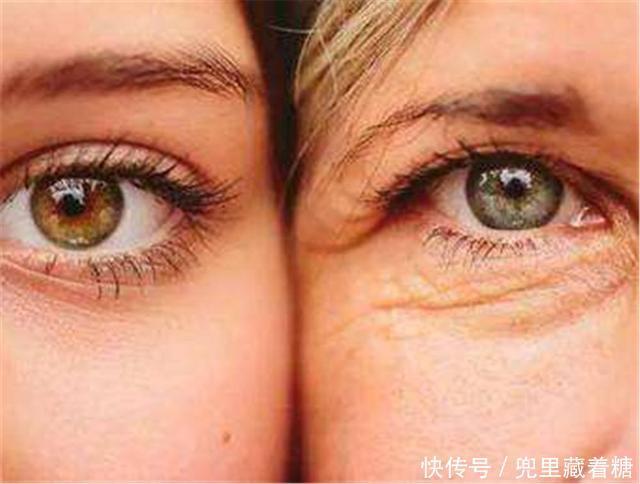 曾经那些割了双眼皮的美女，10年后会变啥样，看完还敢割吗？