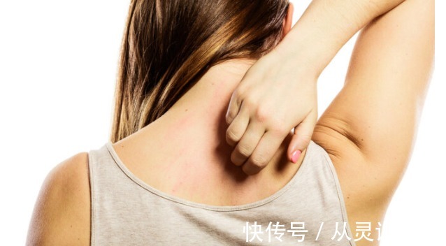 瘙痒|以为的皮肤病,而是癌症信号皮肤出现三种现象,警惕癌症的袭击
