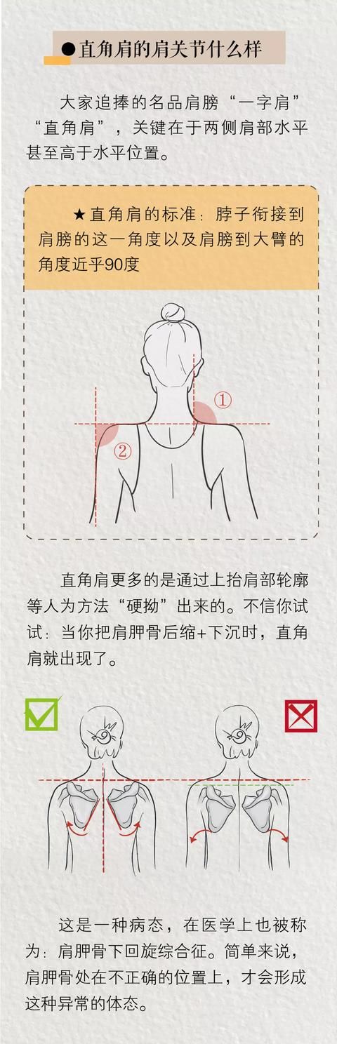 人类|直角肩到底有多“反人类”?骨科医生说出了大实话……