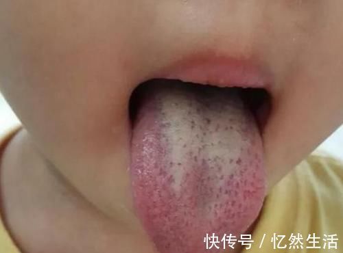 肠胃疾病|夏季孩子易积食,提醒:多吃这“2黄”,或可调节肠胃健康