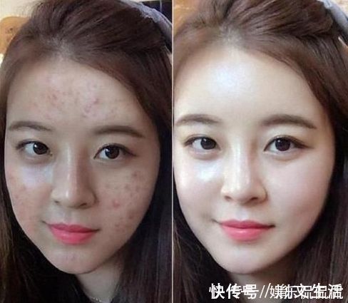 护肤|精华液早晚都得擦一问美容师,好多人弄错,皮肤变差还浪费钱!