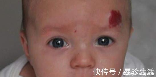 孕妇|不想宝宝长胎记,孕妇就忍住别做这4件事,颜值是一辈子的事