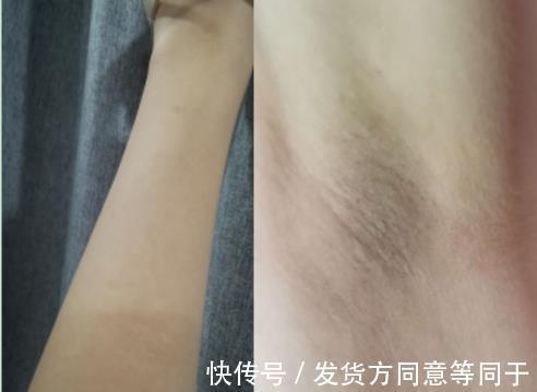 拆君|评测 ｜ 历时30天，真人实测娜蜜丝冰钻6.5高能量光子脱毛仪