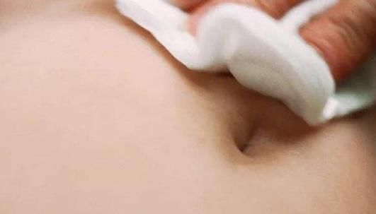 肚脐眼窝里的“黑泥”,到底是如何形成的,需不需要进行清理呢