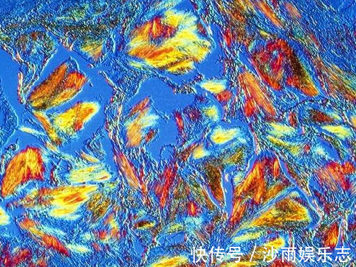 苏打水|痛风患者,喝柠檬水、苏打水能把尿酸降正常吗医生告诉您