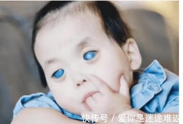 孤儿院|1岁女婴因患“蓝瞳”吓坏父母,却被富豪当宝领养走,如今怎样了