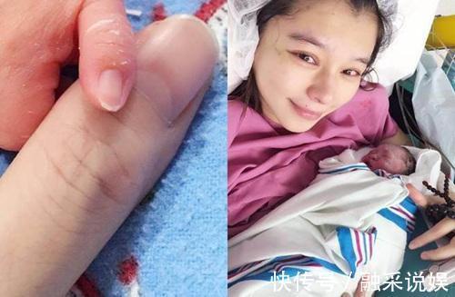 生育|女明星为何宁愿剖腹产留疤,也不愿意顺产背后3个原因,很现实